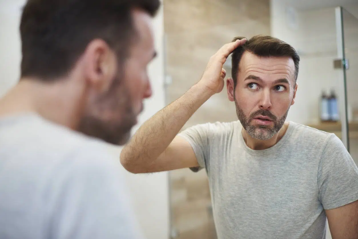 perruque comme solution à perte de cheveux